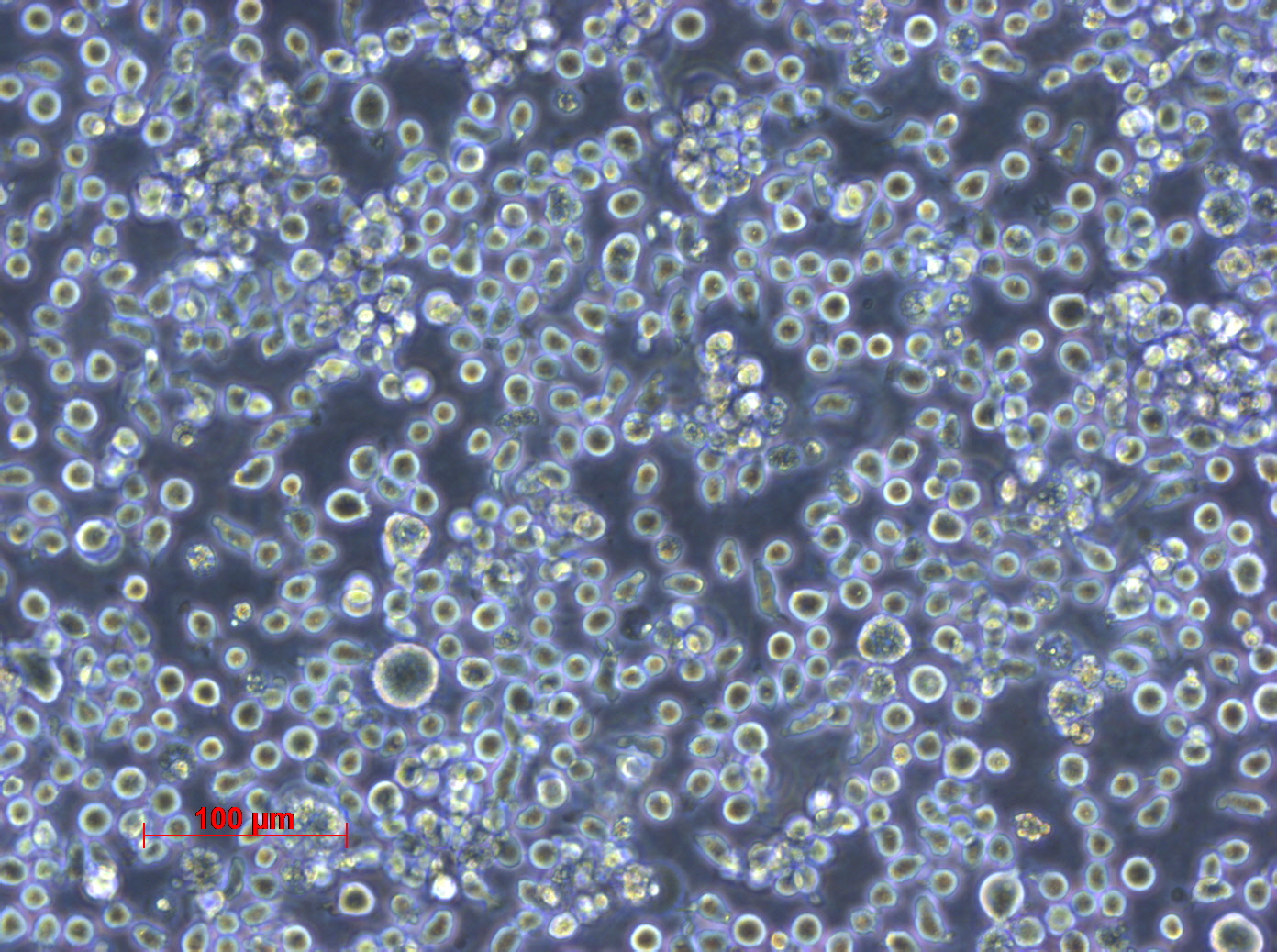 HEL 92.1.7细胞图片